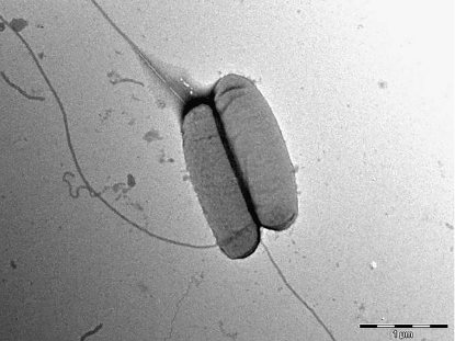 Nova vrsta bakterije, Legionella...